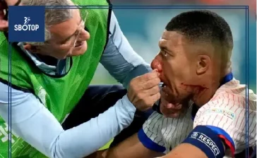 SBOTOP: Adrien Rabiot Gives Positive Euro 2024 Update on Kylian Mbappe's Broken Nose