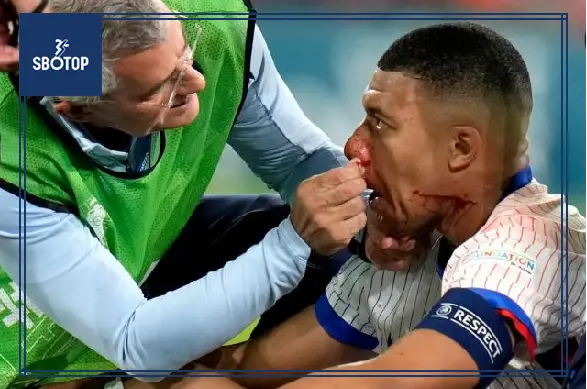 SBOTOP: Adrien Rabiot Gives Positive Euro 2024 Update on Kylian Mbappe's Broken Nose